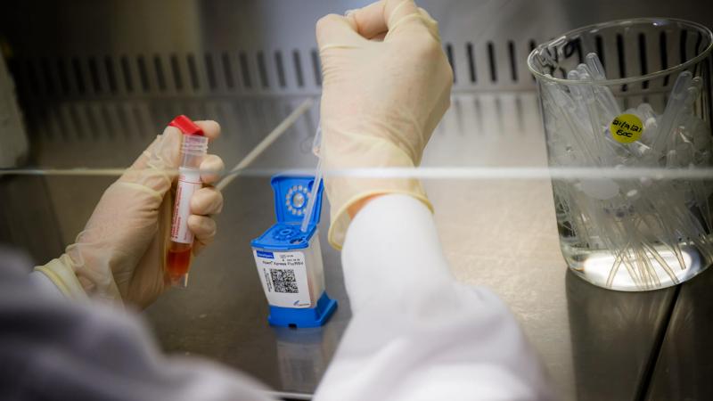 A Clinical Laboratory Technician opening a GeneXpert cartridge in a space and designated area of the laboratory.