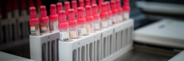 Vials of blood in a holder