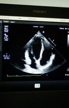 A patients scan shown on a radiologists screen